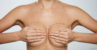 Experience Expert Breast augmentation Miami in Miami post thumbnail image