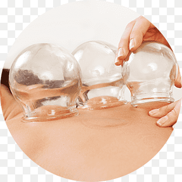 Discover the Benefits of Cupping Therapy Near Me post thumbnail image